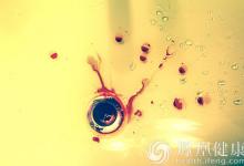 反復鼻出血 竟是高血壓惹的禍!改變生活方式是關鍵