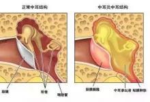 寧波22歲小伙的聽力相當(dāng)于90歲老人!竟然是因這個(gè)習(xí)慣…看完想扔手機(jī)