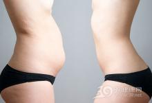 體重正常就健康?有小肚子早死風(fēng)險(xiǎn)大