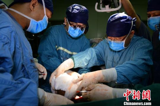 西安醫(yī)學(xué)專家利用磁輔助實(shí)施肝移植 創(chuàng)“無肝期”新紀(jì)錄