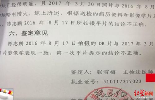 玉佩致胸片陰影誤診？四川勞研科技有限公司體檢顯示正常 男子一年后去世
