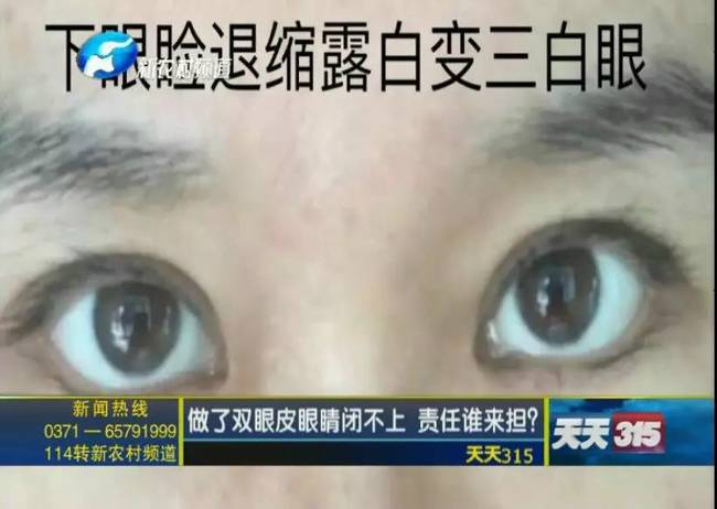 女子整形失敗 許昌華姿醫美整形醫院不認：因為醫生已離職