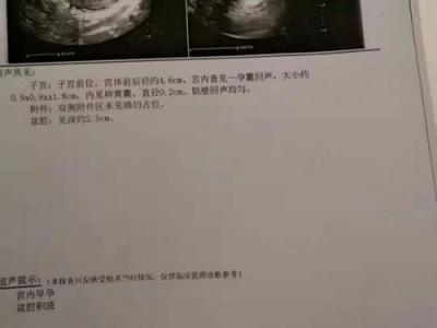 崇州蜀都醫(yī)院無相關(guān)許可證 男子結(jié)扎三個(gè)月后妻子懷孕