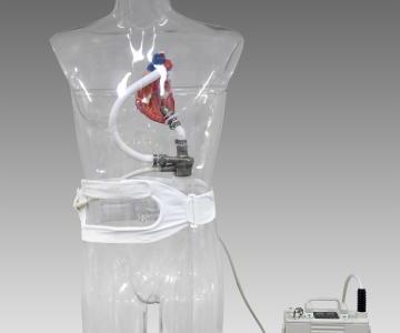 四川進行中國第一例正式上市人工心臟植入手術治療