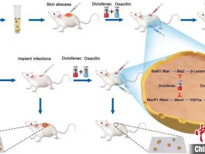 專家發(fā)現(xiàn)骨關節(jié)術后感染防治新策略:傳統(tǒng)藥物對抗超級耐藥菌“顯身手”