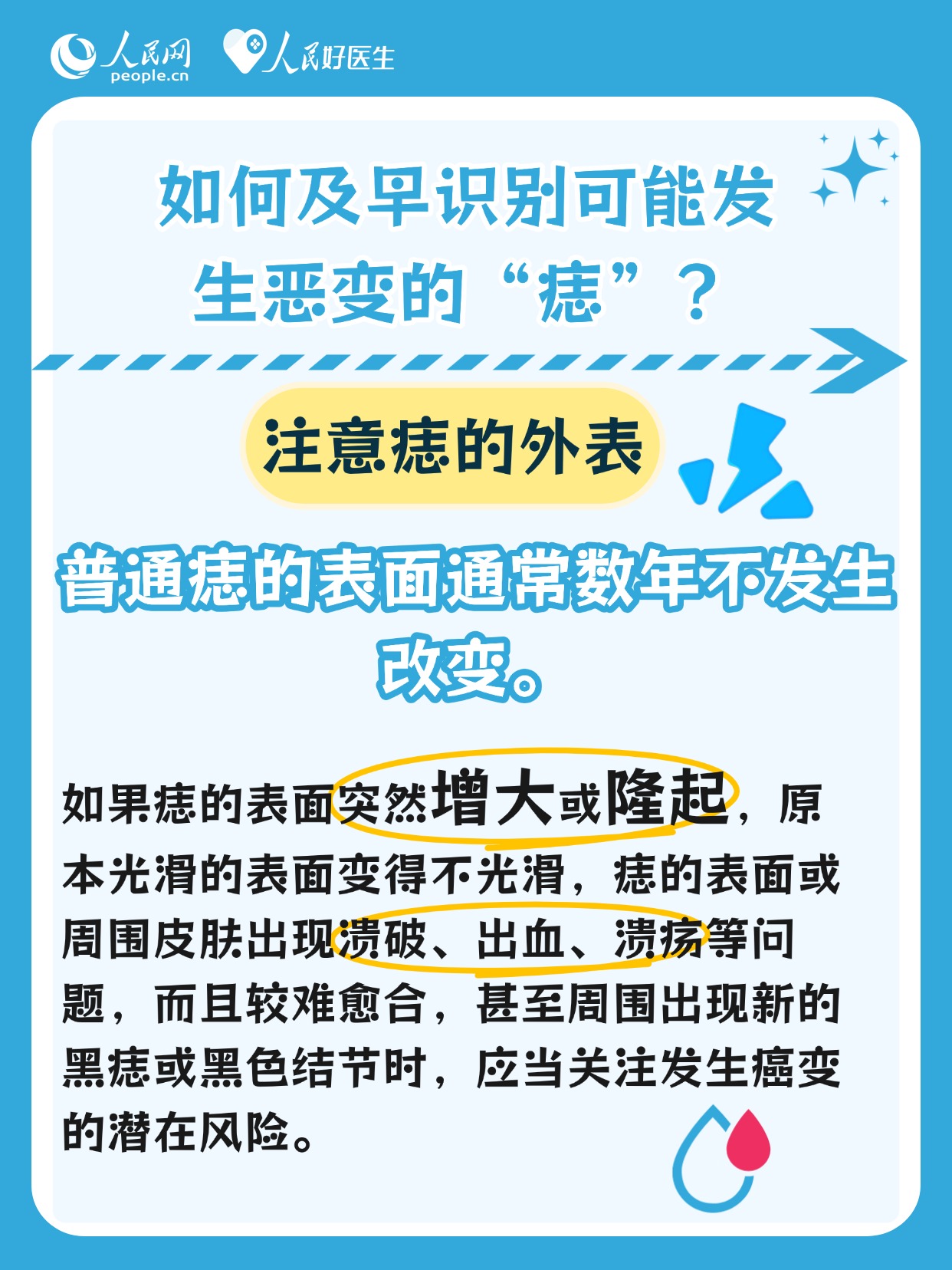 身上有痣的人注意了！這些痣可能會發生癌變