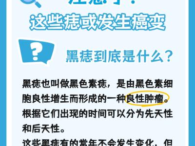 身上有痣的人注意了！這些痣可能會發生癌變