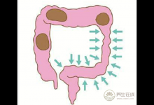 食療養(yǎng)生:常吃這些食物能養(yǎng)胃