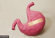 胃癌“挑人”有三大標準,符合一個也難逃