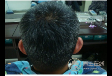 擔心白發一直冒出來？4大養發食物告訴你