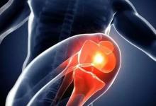 膝關節為什么會發出彈響？