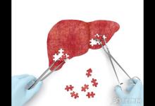 堅持這五個小習慣，養(yǎng)肝護肝不在話下