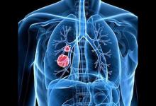 長期吃梨有潤肺止咳的功效嗎?