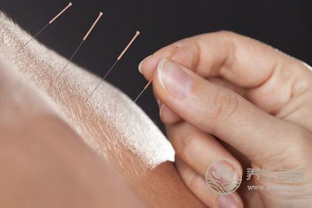 針灸減肥效果好不好呢 針灸減肥效果好不好呢
