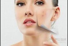 痘痘星人看過來，這3種食物咱別吃了，再好吃為了美也要忍