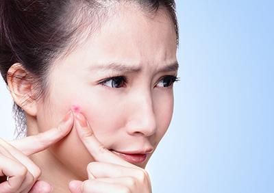 臉上長(zhǎng)粉刺的原因?yàn)槭裁聪掳吞帟?huì)起粉刺