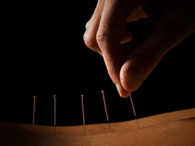 針灸的針扎在身上的時候會不會疼-易網健康<a href=http://m.logojc.com/jkys/ target=_blank class=infotextkey>養(yǎng)生</a>網 針灸的針扎在身上的時候會不會疼