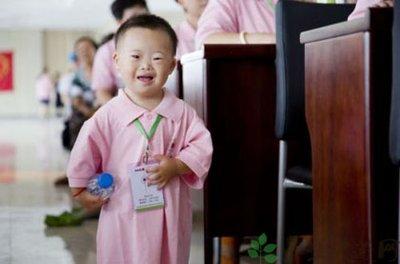 小孩患有唐氏綜合癥會有哪些明顯癥狀