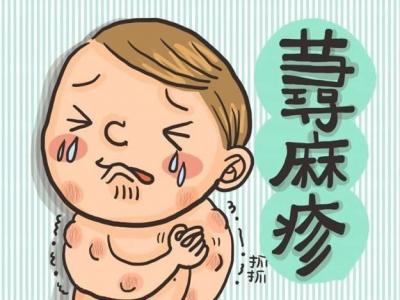 蕁麻疹有哪些治療效果比較好的方法