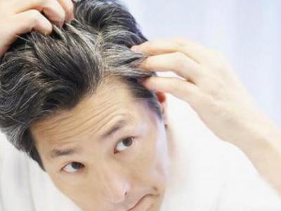 導(dǎo)致年輕人白發(fā)越長(zhǎng)越多的兩種原因