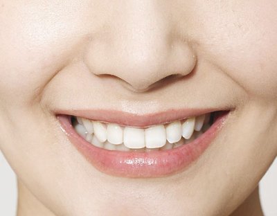 牙齦發(fā)炎的癥狀以及牙齦發(fā)炎的解決方法-易網(wǎng)健康<a href=http://m.logojc.com/jkys/ target=_blank class=infotextkey>養(yǎng)生</a>網(wǎng) 牙齦發(fā)炎的癥狀以及牙齦發(fā)炎的解決方法