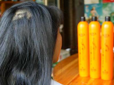 導致頭發變黃脫發的幾種常見原因