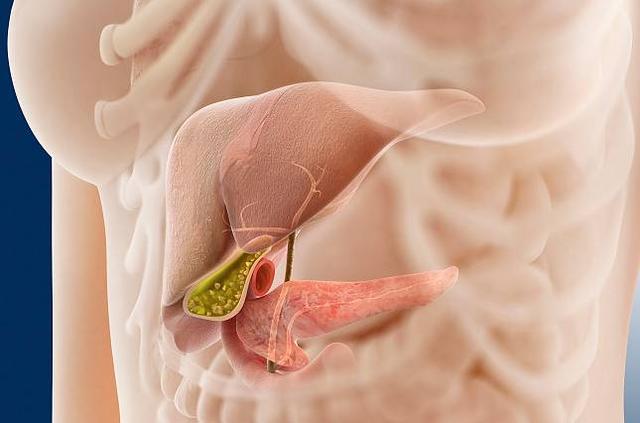 結(jié)石患者在生活中可以多吃核桃嗎