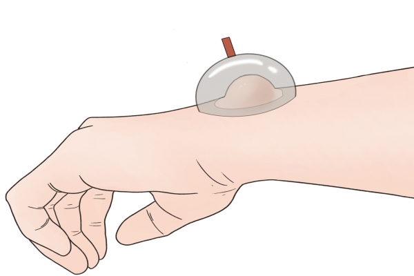 三伏天中午可以拔火罐嗎 三伏天拔罐的最佳時間-易網健康養生網 三伏天中午可以拔火罐嗎 三伏天拔罐的最佳時間