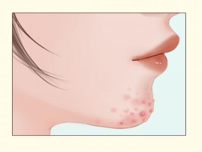 三伏天里該如何保養(yǎng)皮膚 三伏天護(hù)膚小妙招