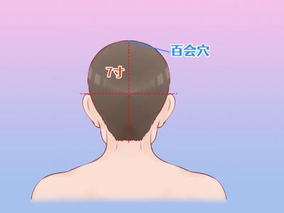 三伏天針灸的注意事項 針灸的好處和方法