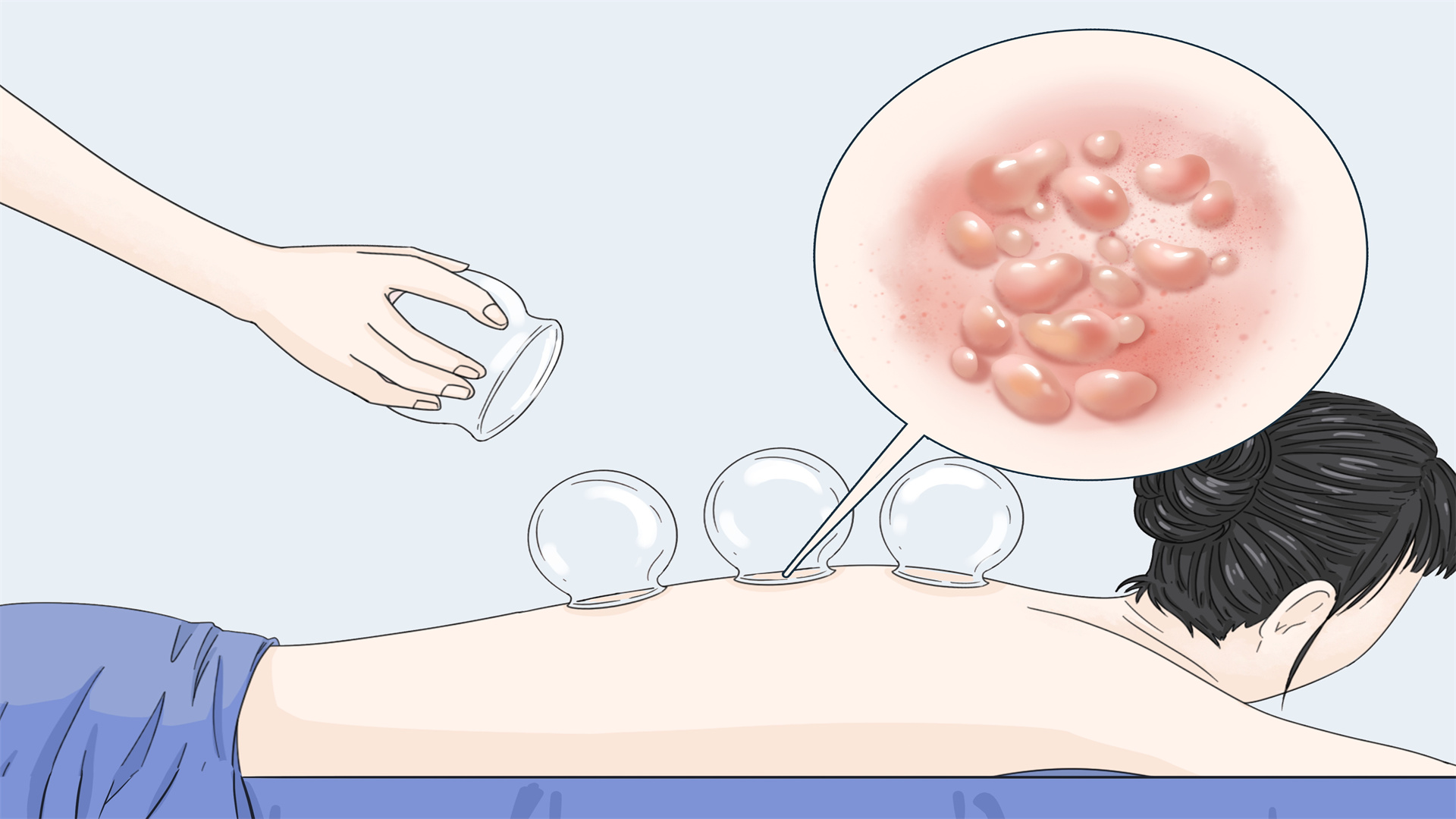 身體祛濕的最好方法有哪幾種 濕氣重人們如何調理-易網健康<a href=http://m.logojc.com/jkys/ target=_blank class=infotextkey>養生</a>網 身體祛濕的最好方法有哪幾種 濕氣重人們如何調理