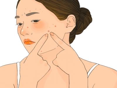 體寒卻肝火旺臉上總長痘怎么調(diào)理 寒濕臉上長痘還是濕熱長痘