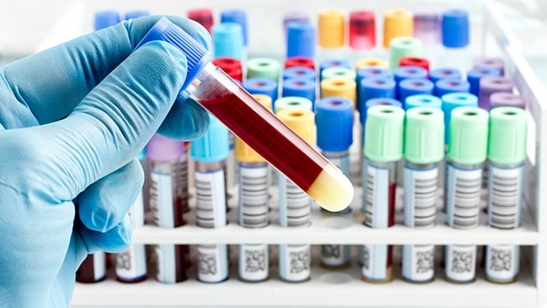 性激素六項檢查注意事項有哪些 性激素六項的參考范圍是什么-易網<a href=http://m.logojc.com/ target=_blank class=infotextkey>健康養生</a>網 性激素六項檢查注意事項有哪些 性激素六項的參考范圍是什么