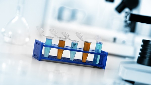 性激素六項檢查注意事項有哪些 性激素六項的參考范圍是什么-易網健康<a href=http://m.logojc.com/jkys/ target=_blank class=infotextkey>養生</a>網 性激素六項檢查注意事項有哪些 性激素六項的參考范圍是什么