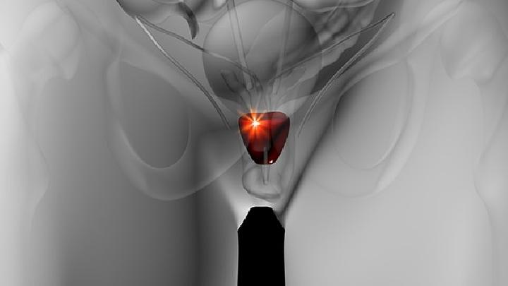 男性性功能障礙怎樣預防比較好？為什么心理因素會影響性功能？