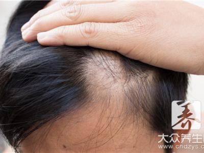 縱欲過度掉頭發(fā)還長(zhǎng)嗎