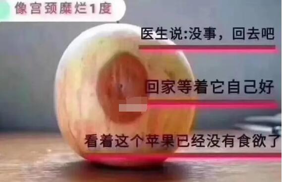 宮頸糜爛一二三度圖片,真實(shí)對(duì)比照片(小心是宮頸癌前兆)-易網(wǎng)<a href=http://m.logojc.com/ target=_blank class=infotextkey>健康養(yǎng)生</a>網(wǎng) 宮頸糜爛一二三度圖片,真實(shí)對(duì)比照片(小心是宮頸癌前兆)