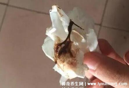 宮頸糜爛一二三度圖片,真實(shí)對(duì)比照片(小心是宮頸癌前兆)-易網(wǎng)健康養(yǎng)生網(wǎng) 宮頸糜爛一二三度圖片,真實(shí)對(duì)比照片(小心是宮頸癌前兆)