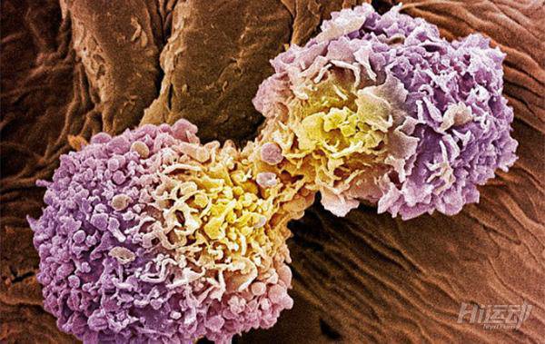 有研究表明肥胖能影響多種疾病，看完你還敢“胖”嗎？