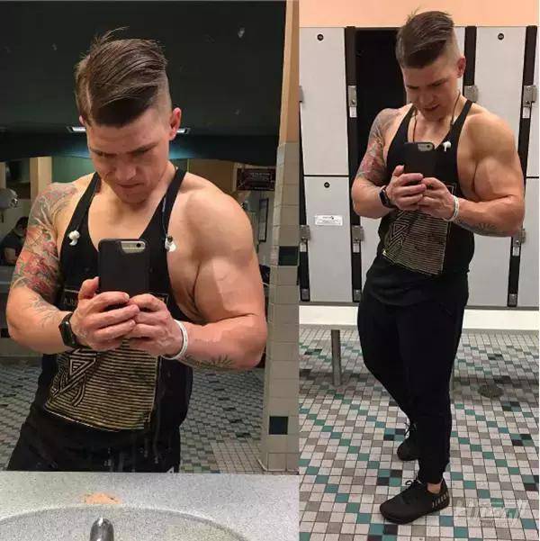 胖子成功減肥200斤，皮膚松弛也坦然面對！