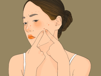 瑜伽可以祛痘嗎