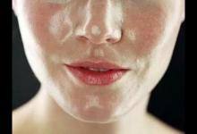 油性皮膚如何改善?皮膚科醫生有4個建議！