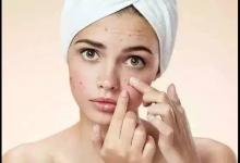 專家提醒:同時使用多種祛痘產品要謹慎