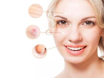 女性面部皮膚下垂怎么辦，四個方法延緩衰老