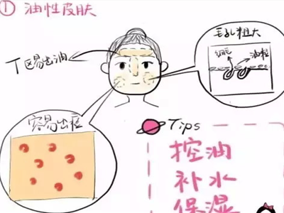 你是干性還是油性肌膚,膚質不同護膚措施也不同