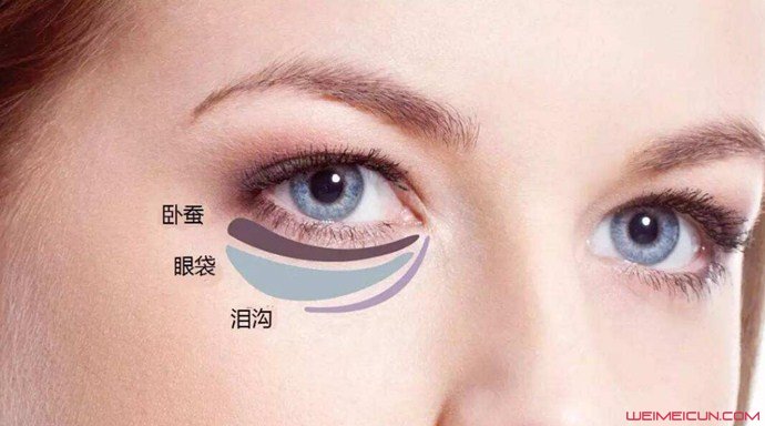 怎樣去除眼袋最有效的方法是什么 幾個實用小妙招推薦-易網<a href=http://m.logojc.com/ target=_blank class=infotextkey>健康養生</a>網 怎樣去除眼袋最有效的方法是什么 幾個實用小妙招推薦