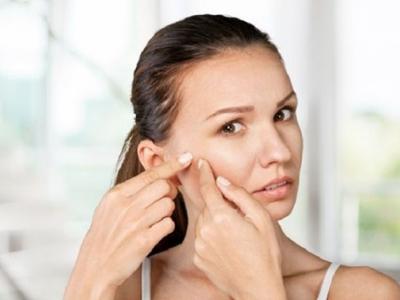 為什么不能用手擠痘痘？用手擠痘痘的危害