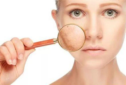 春季容易皮膚瘙癢 原來是這4個原因造成的！