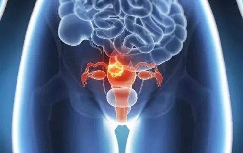 怎樣保養卵巢和子宮?日常注意這些事-易網<a href=http://m.logojc.com/ target=_blank class=infotextkey>健康養生</a>網 怎樣保養卵巢和子宮?日常注意這些事