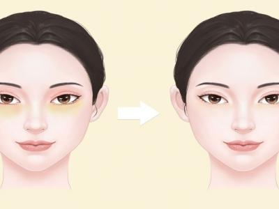 眼袋怎么消除簡(jiǎn)單方法